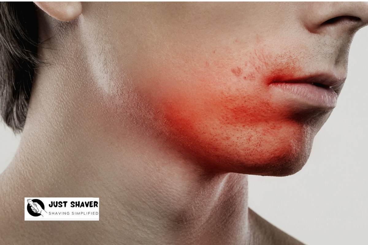 What Causes Breaking Out After Shaving And How To Prevent It Just Shaver